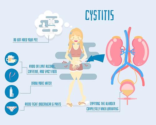 Interstitial Cystitis