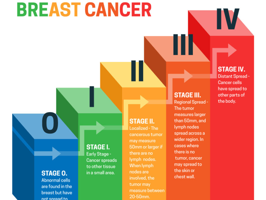 Understanding the 5 Stages of Breast Cancer and Prognosis