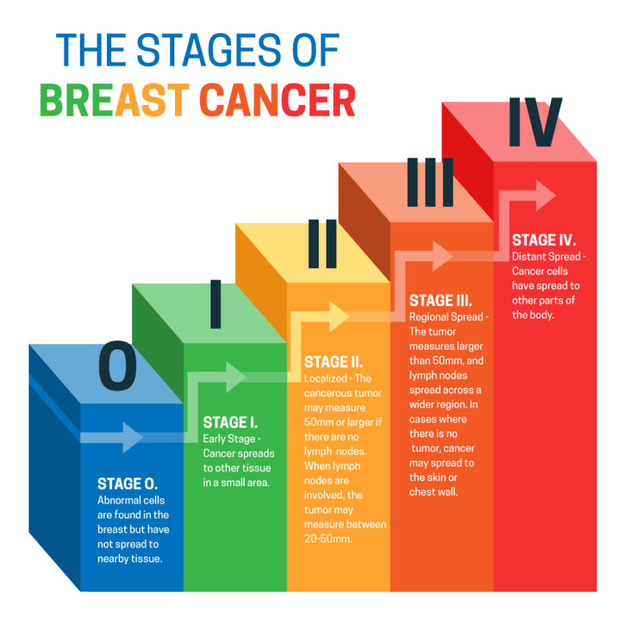 Stages of breast cancer