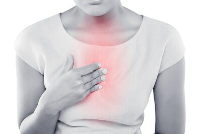 Gastroesophageal reflux disease